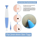 Skin Tag Removal Kit - Eminence International